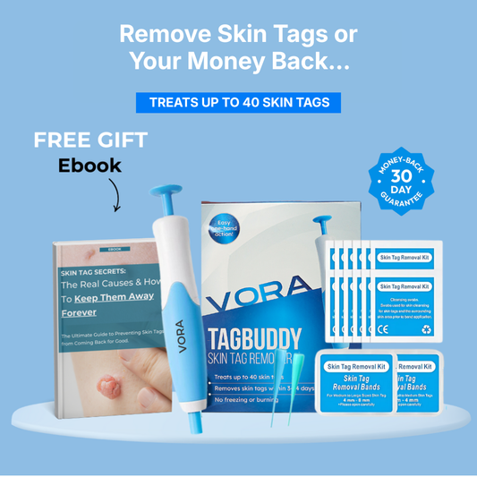 HeyVelva™ – No More Skin Tags